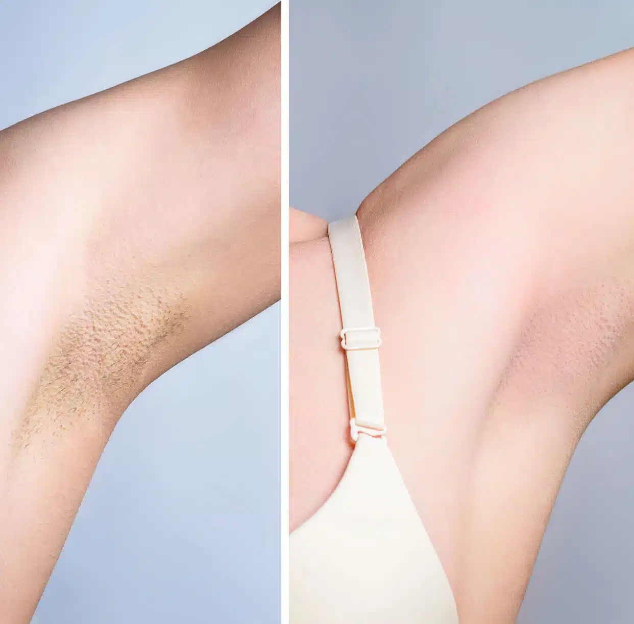 Bikini Wax Before And After