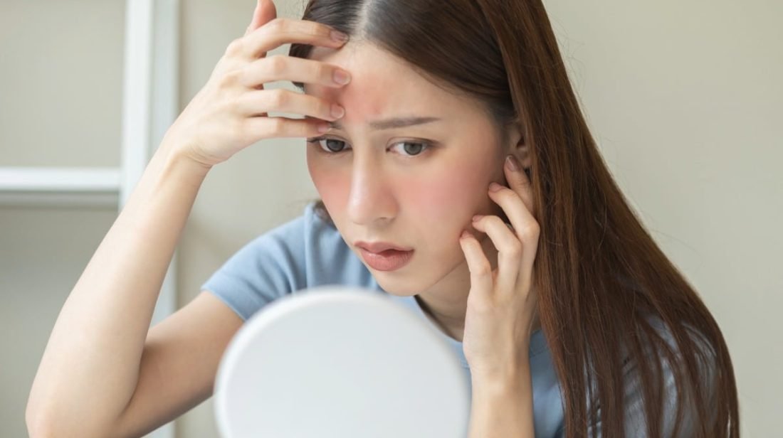 Wax My Brows While Using Acne Products